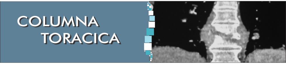 cadera adulto